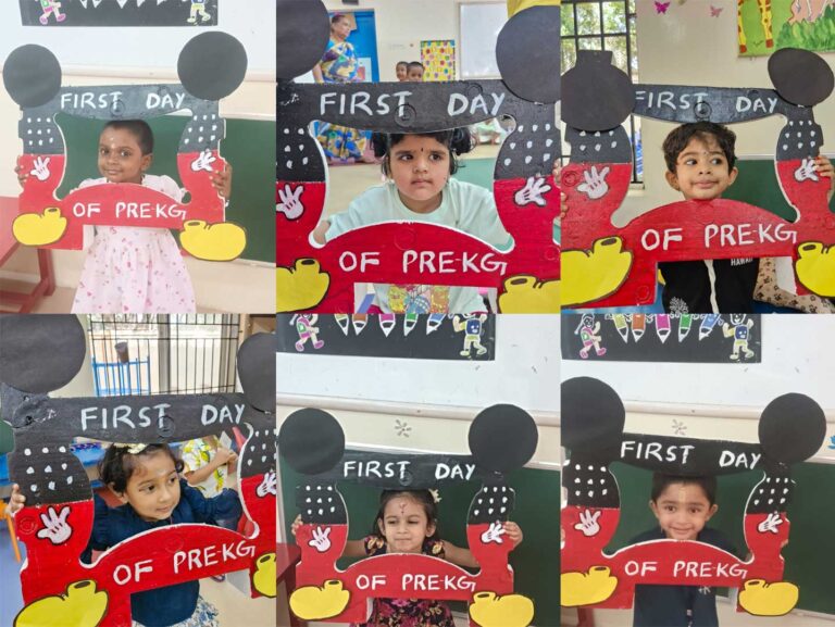 Prekg1